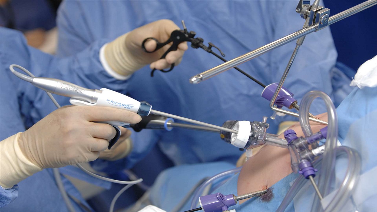 انجام جراحی توسط جراح متخصص و با مهارت با دستگاه های مخصوص