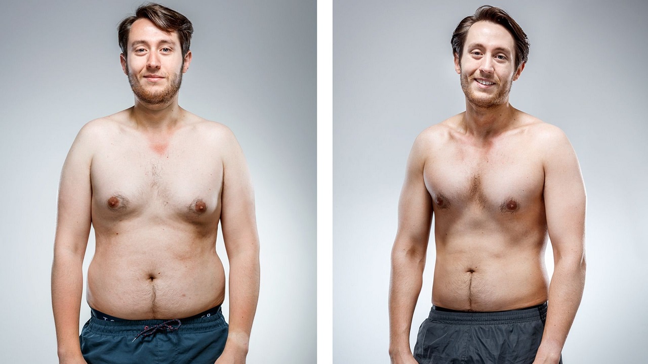 قبل و بعد ورزش پس از جراحی