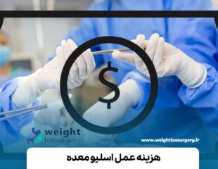 هزینه عمل اسلیو معده