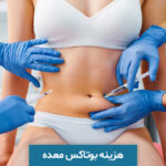 هزینه بوتاکس معده