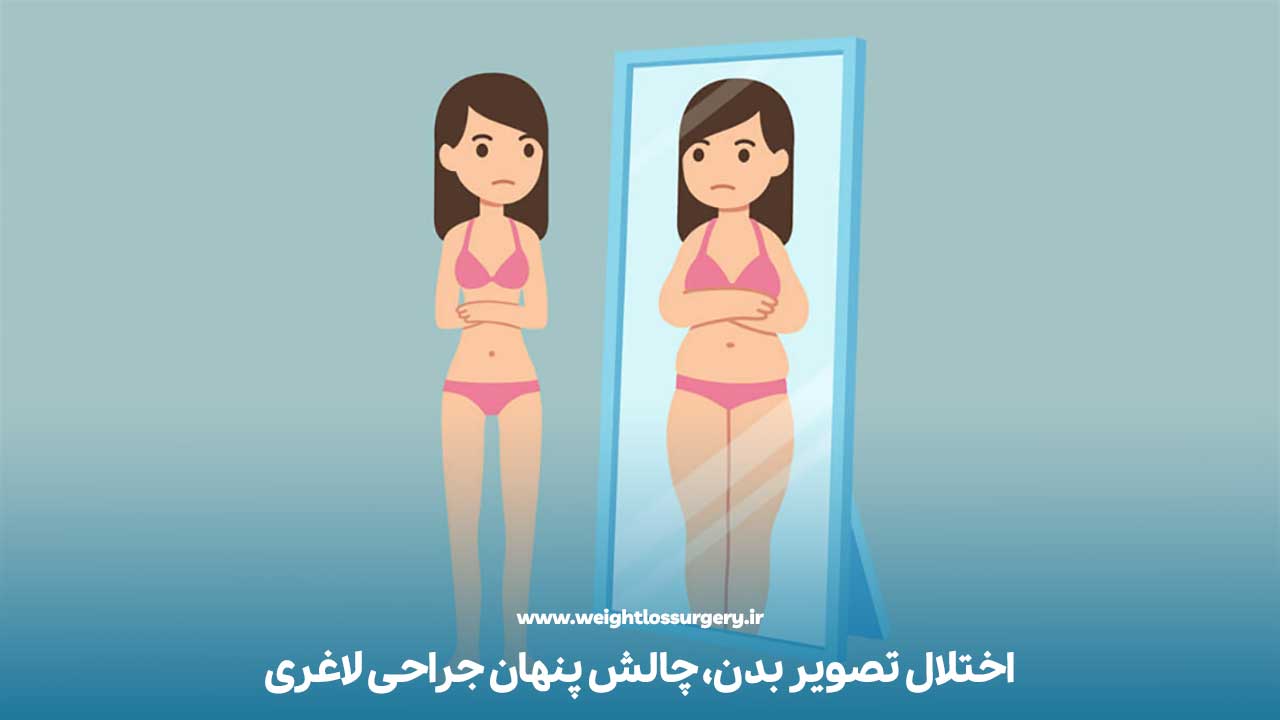 اختلال در تصویر بدن
