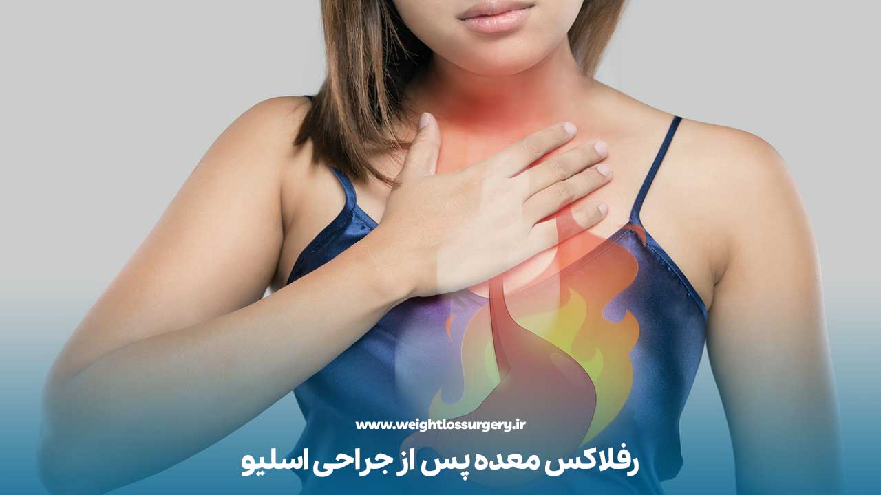 رفلاکس معده پس از جراحی اسلیو