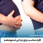 افراد مناسب برای جراحی اسلیو معده