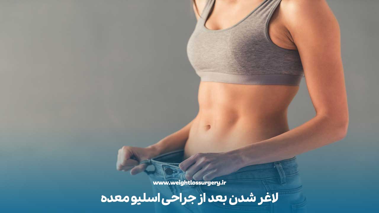 لاغر شدن بعد از جراحی اسلیو معده