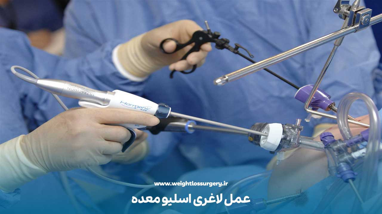 حین جراحی اسلیو