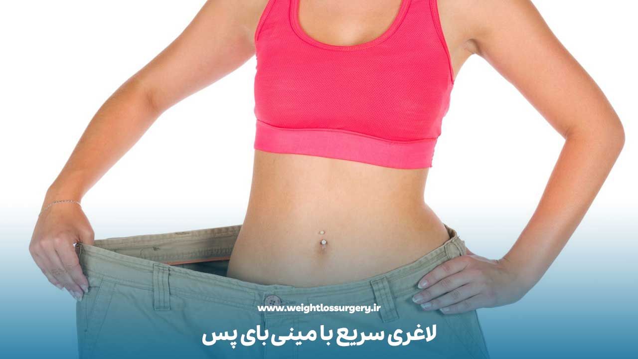 لاغری سریع بعد از عمل بای پس