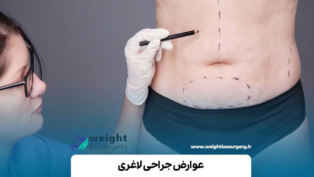 عوارض جراحی لاغری