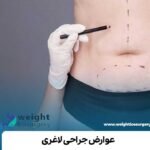 عوارض جراحی لاغری