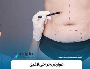 عوارض جراحی لاغری