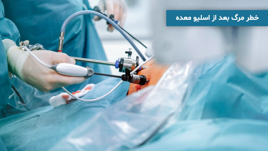 خطر مرگ بعد از اسلیو معده