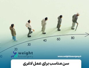 سن مناسب عمل لاغری