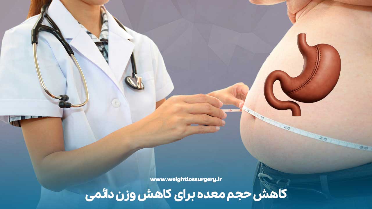 عمل اسلیو معده چیست؟