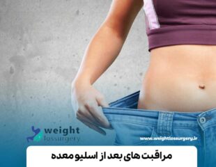 مراقبت های بعد از اسلیو معده