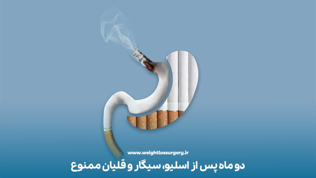 سیگار و قلیان بعد از اسلیو معده