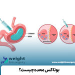 بوتاکس معده