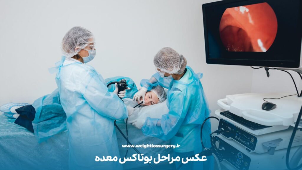عکس مراحل بوتاکس معده