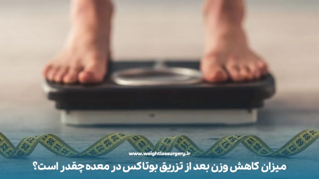 میزان کاهش وزن بعد از تزریق بوتاکس در معده چقدر است؟