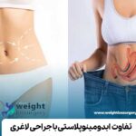 تفاوت ابدومینوپلاستی با جراحی لاغری