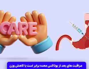 مراقبت های بعد از بوتاکس معده