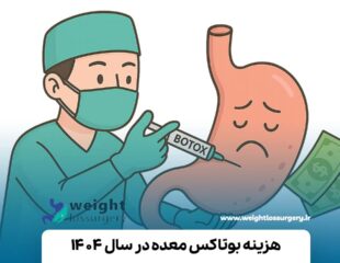 هزینه بوتاکس معده 1404