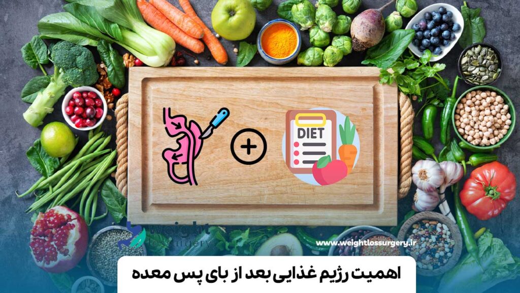 اهمیت رژیم غذایی بعد از بای پس معده
