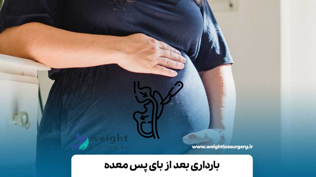 بارداری بعد از بای پس معده