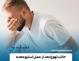 حالت تهوع بعد از عمل اسلیو معده