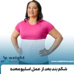 شکم بند بعد از عمل اسلیو معده