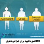 BMI مورد تایید برای جراحی لاغری