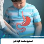 اسلیو معده کودکان