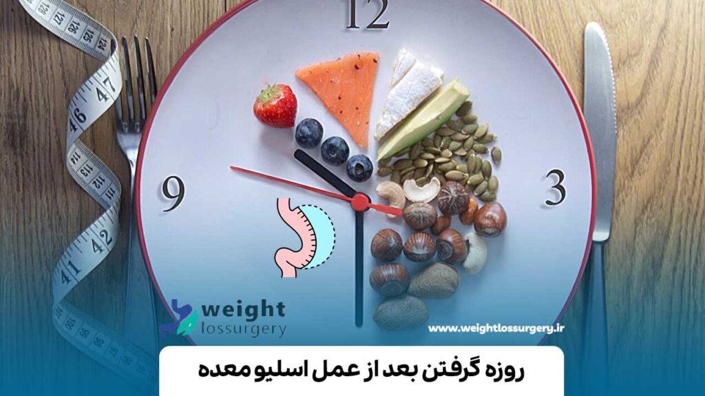 روزه گرفتن بعد از عمل اسلیو معده