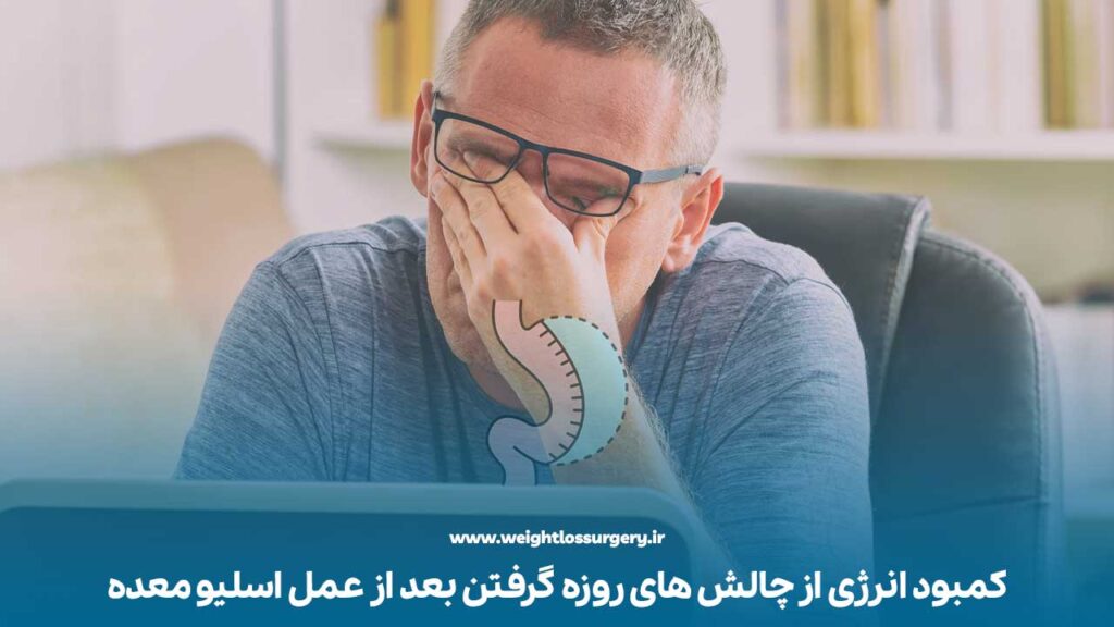 کمبود انرژی از چالش های روزه گرفتن بعد از عمل اسلیو معده