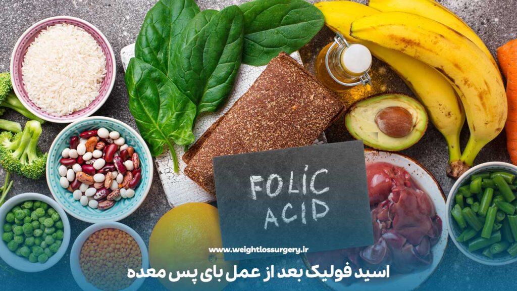 اسید فولیک بعد از عمل بای پس معده