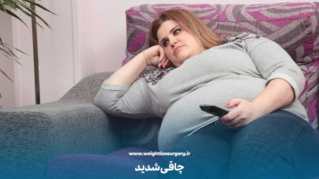 چاقی شدید