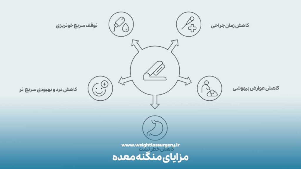 مزایای منگنه معده