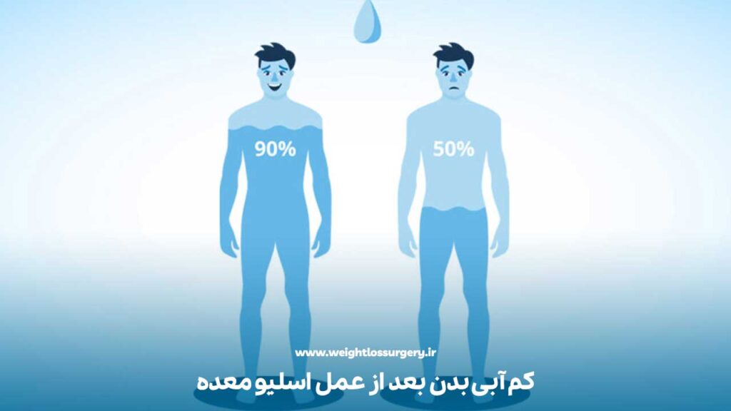 کم آبی بدن جز انواع علت ضعف بعد از عمل اسلیو معده