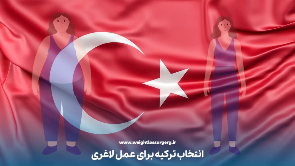 انتخاب کشور ترکیه برای عمل لاغری