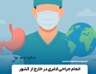 انجام جراحی لاغری در خارج از کشور