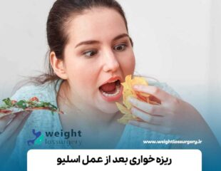 ریزه خواری بعد از عمل اسلیو