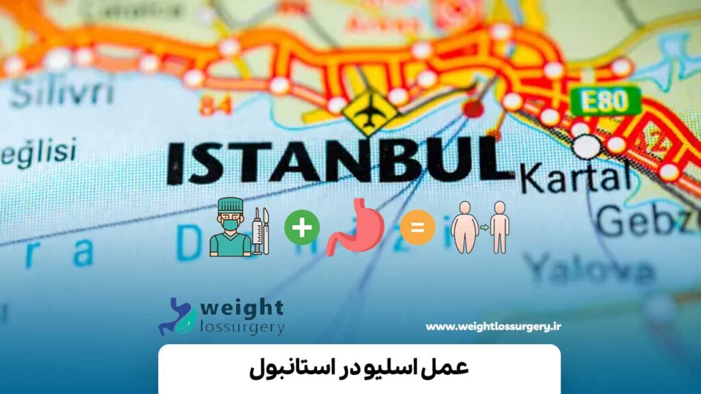 عمل اسلیو در استانبول