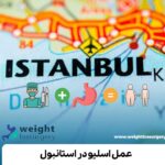 عمل اسلیو در استانبول