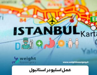 عمل اسلیو در استانبول