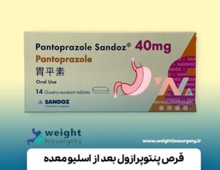 قرص پنتوپرازول بعد از اسلیو معده