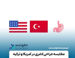 مقایسه جراحی لاغری در آمریکا و ترکیه