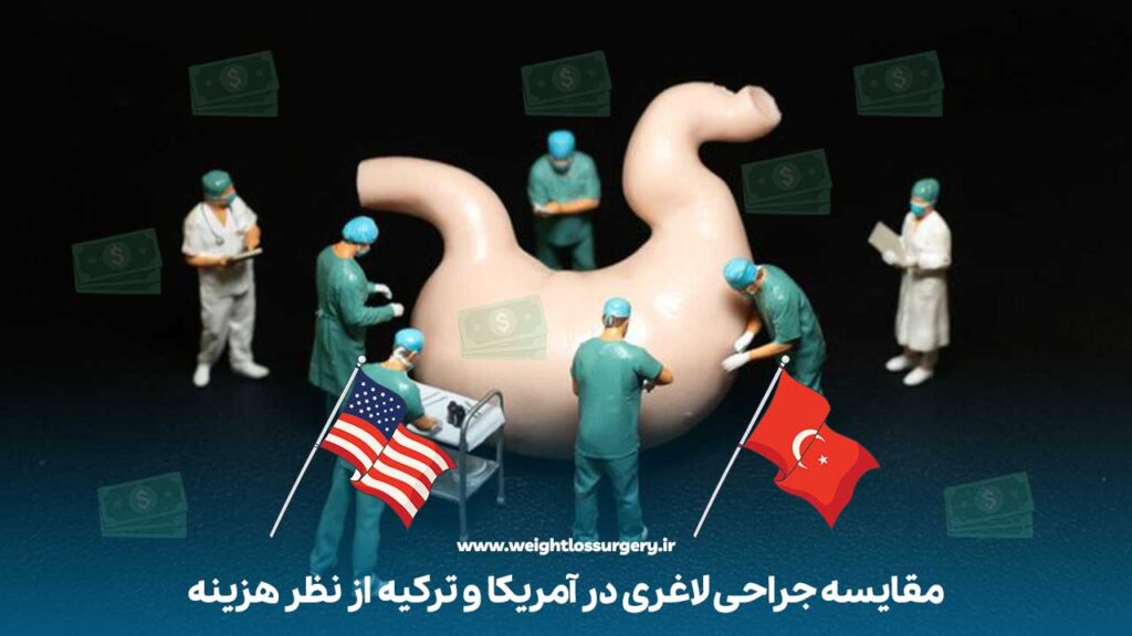 مقایسه جراحی لاغری در آمریکا و ترکیه از نظر هزینه