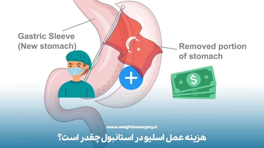 هزینه عمل اسلیو در استانبول