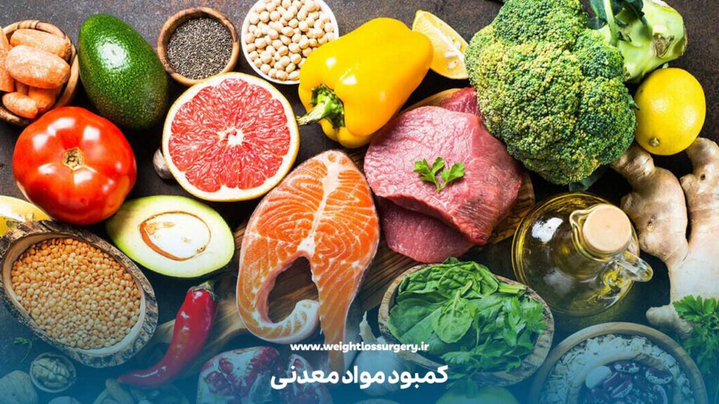 کمبود مواد معدنی بعد از عمل اسلیو معده