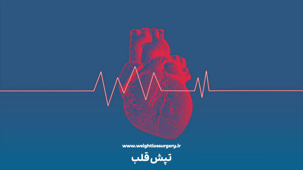 تپش قلب