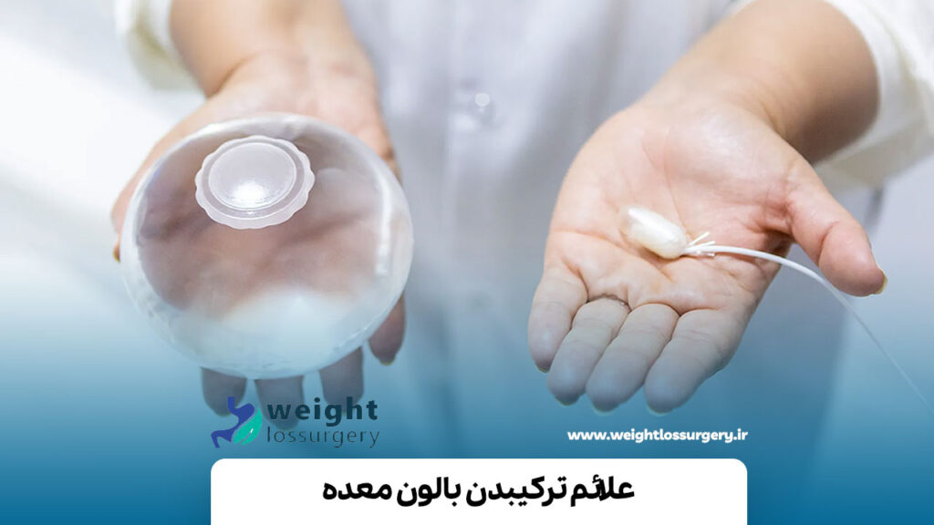 علائم ترکیدن بالن معده