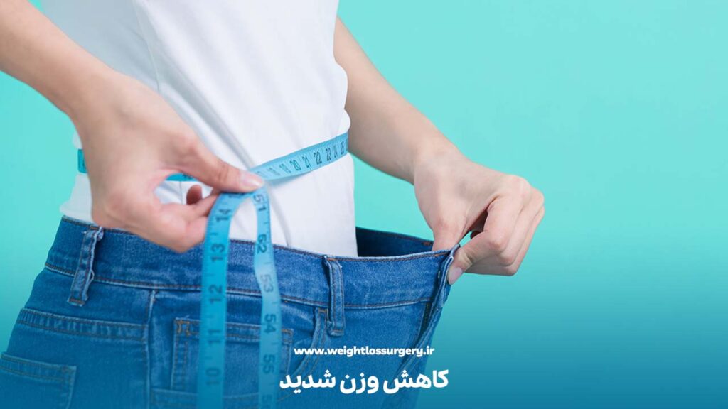 کاهش وزن شدید